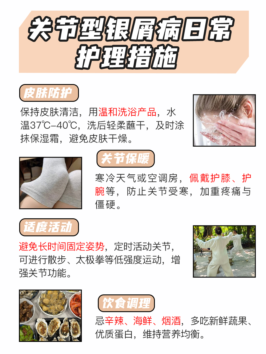 关节型银屑病咋处理?治疗法别错过