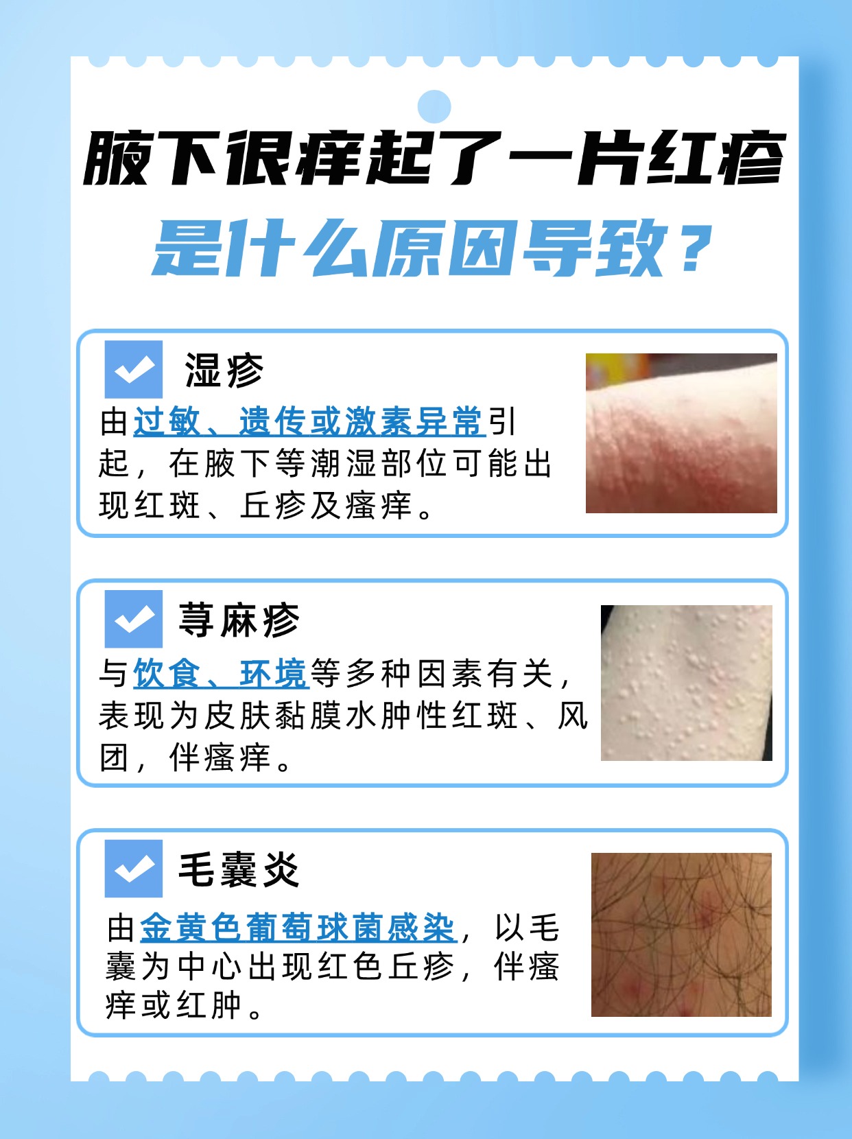 腋下很痒起了一片红疹，原因在这里