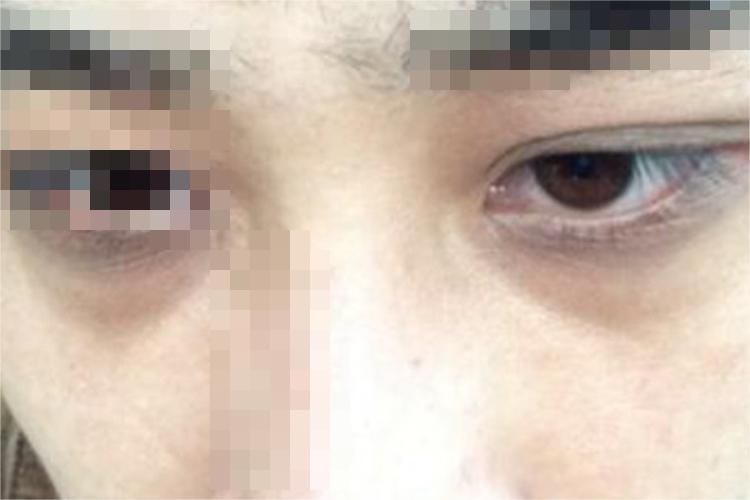 男人肾阳虚脸部症状图