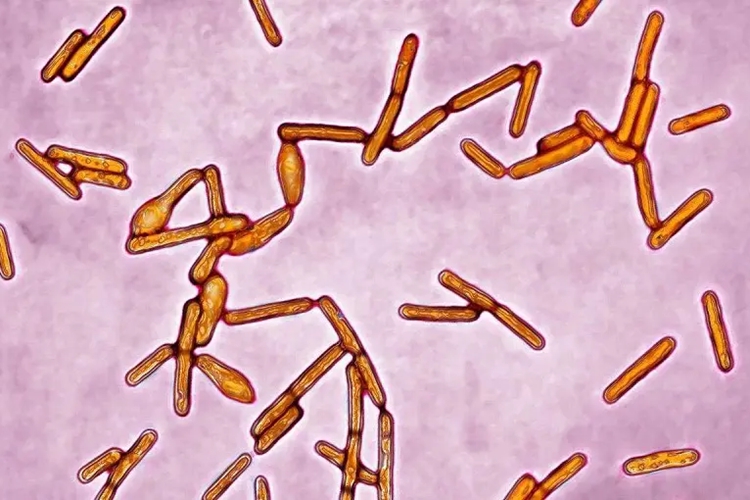 肉毒杆菌图 肉毒杆菌图