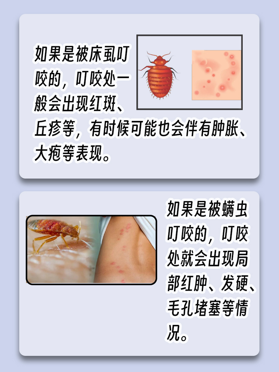床虱和螨虫叮咬，你还在傻傻分不清吗？