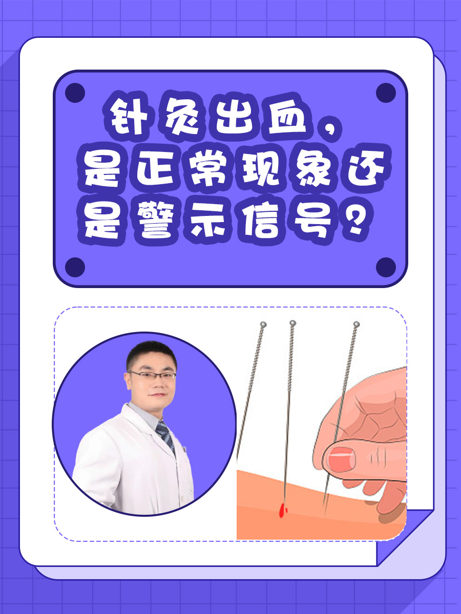 针灸出血,是正常现象还是警示信号?