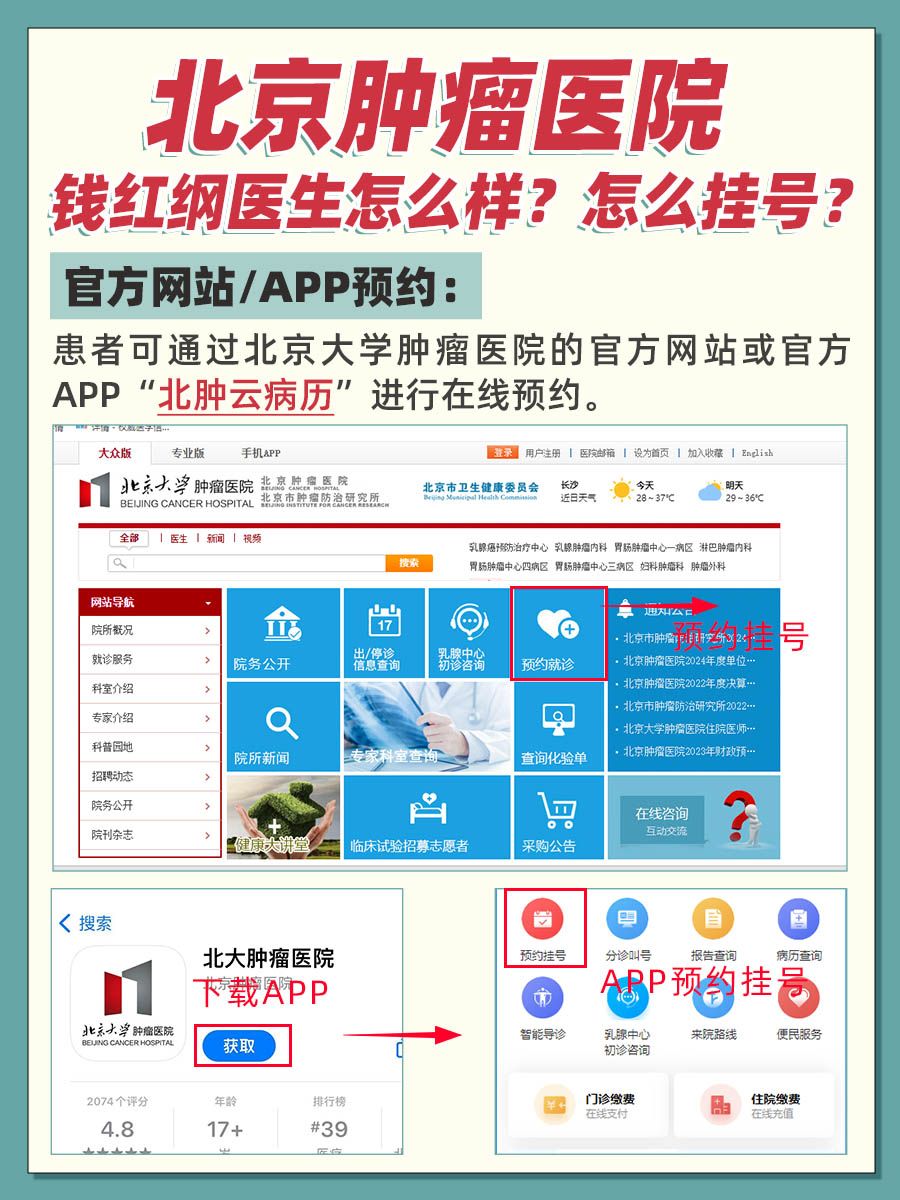 北京肿瘤医院钱红纲医生怎么样?怎么挂号?