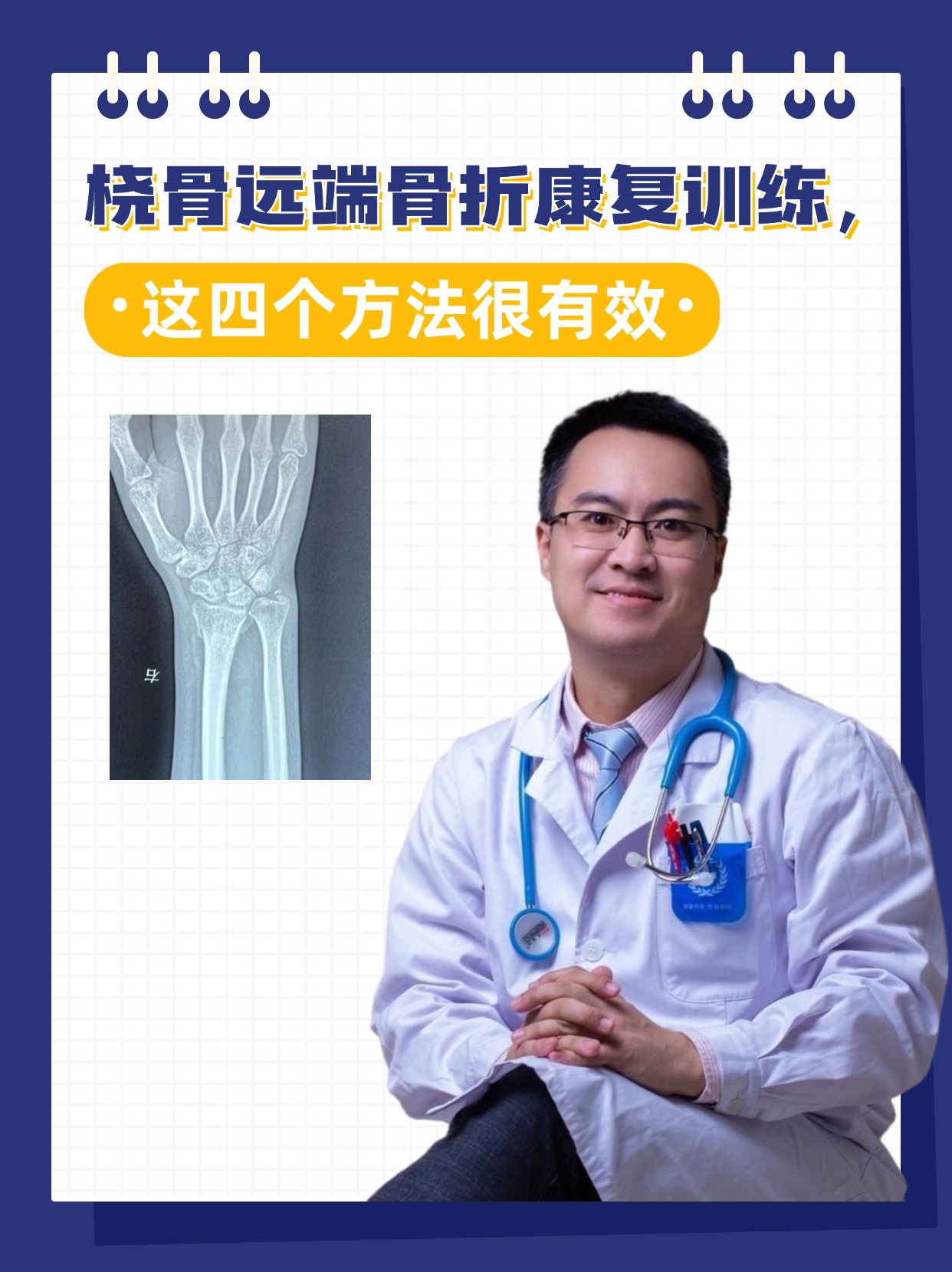 桡骨远端骨折康复训练，这四个方法很有效