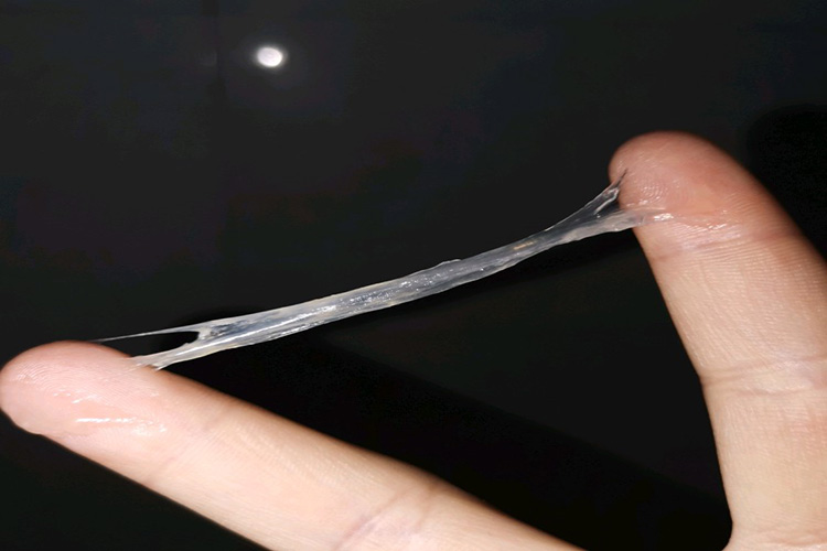 正常白带图 正常白带图