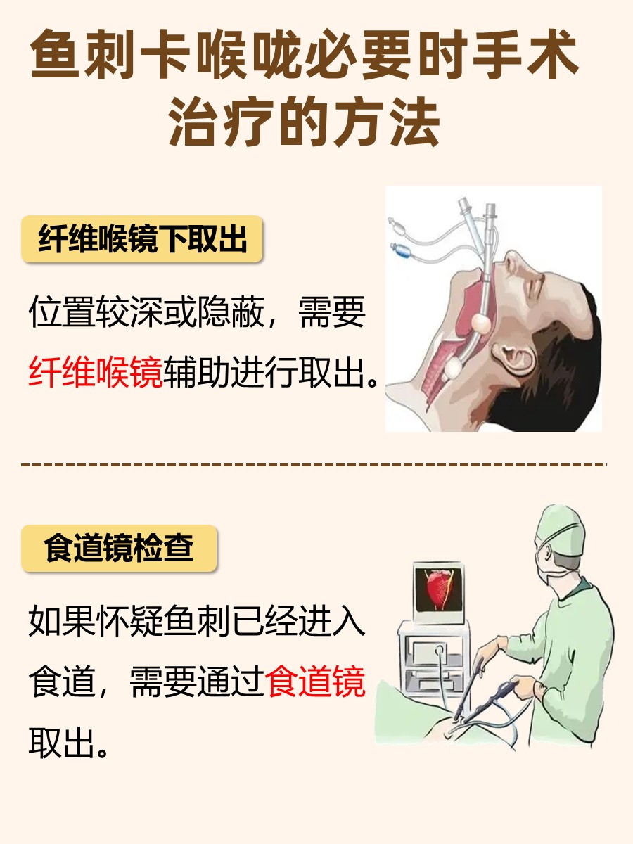 探究：鱼刺卡喉咙的处理措施有哪些？