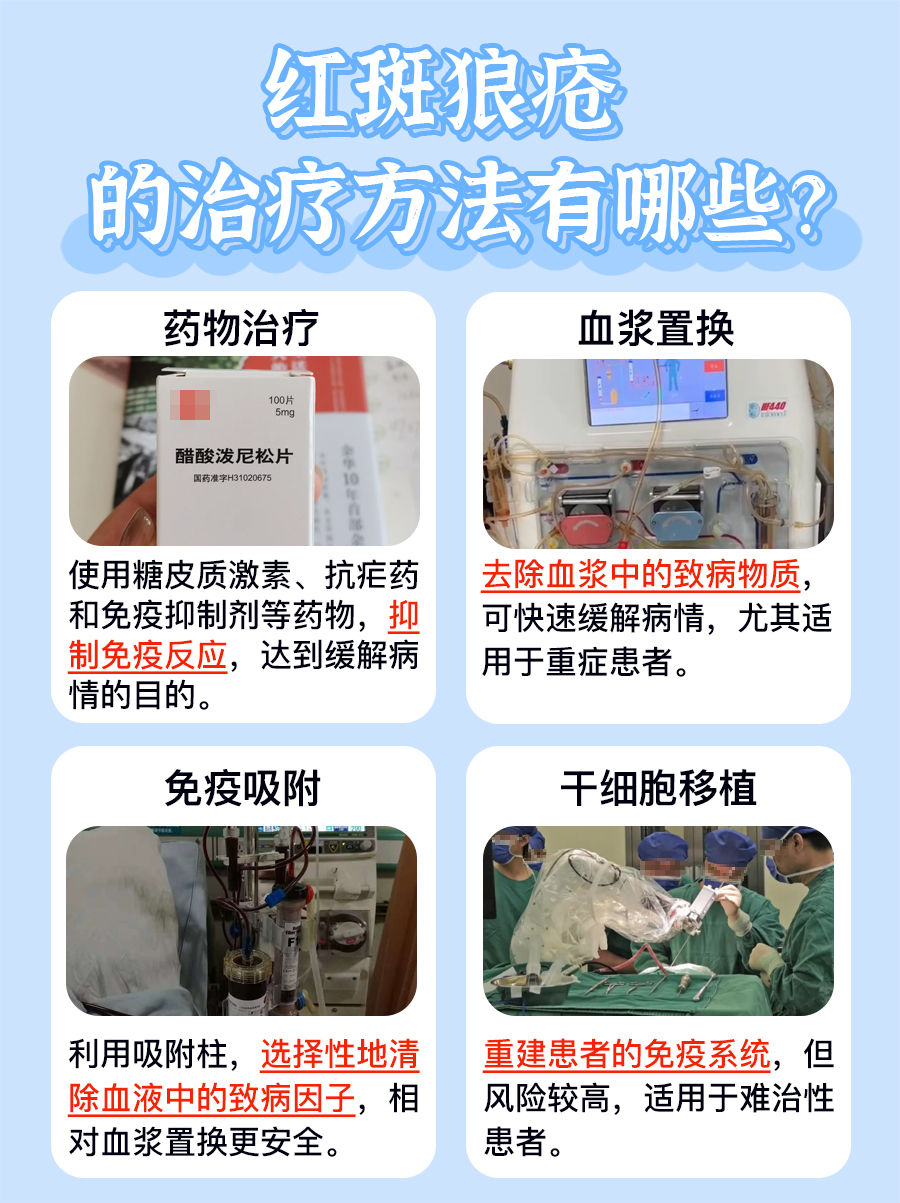 红斑狼疮：潜伏期究竟有多长？