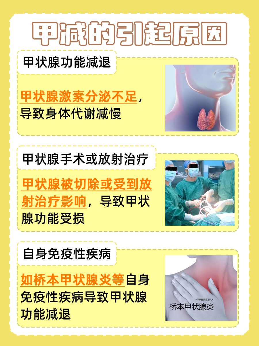 甲减患者，中药助减重真能如愿以偿？医生详解