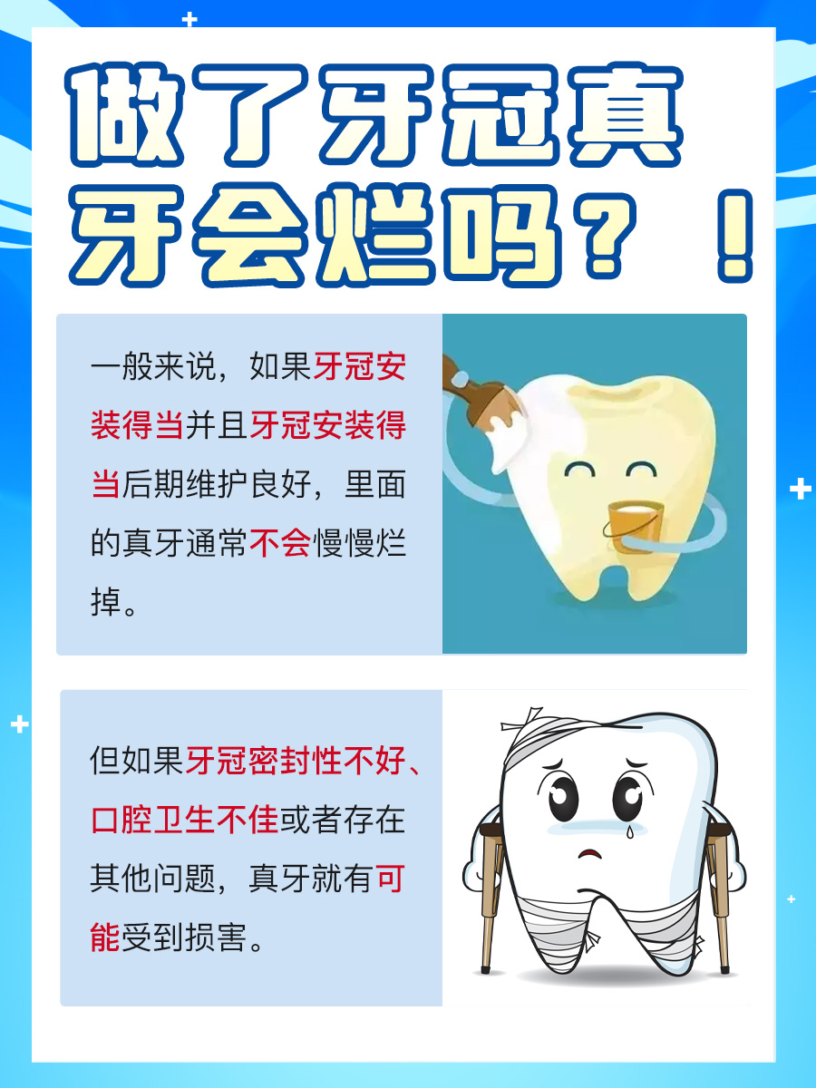 牙冠做了,真牙会烂吗?揭秘真相!