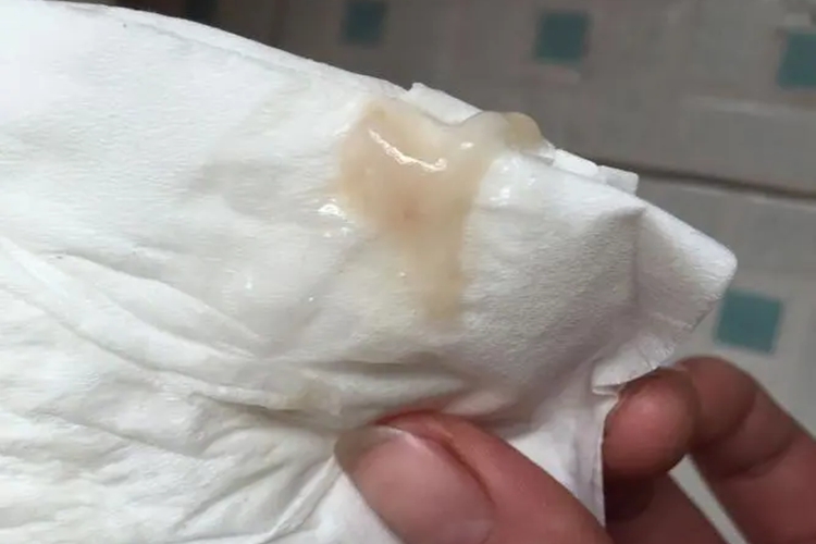 怀孕流灰色东西图 怀孕流灰色东西图