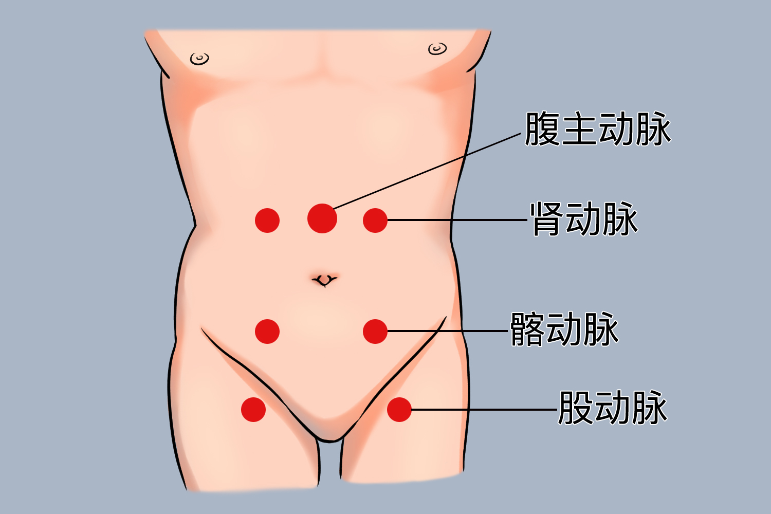 动脉性杂音听诊部位图