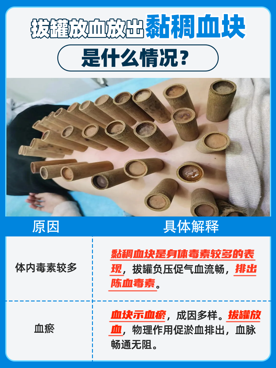 拔罐放血，黏稠血块背后的秘密