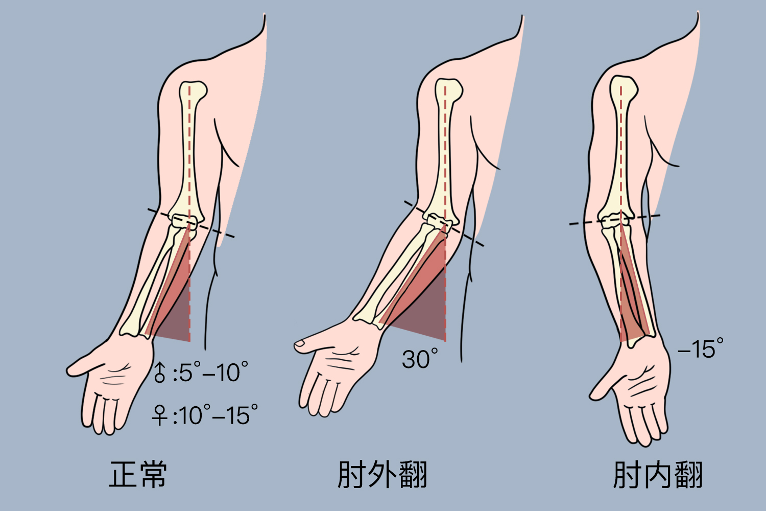 肘关节测量对比示意图 肘关节测量对比示意图