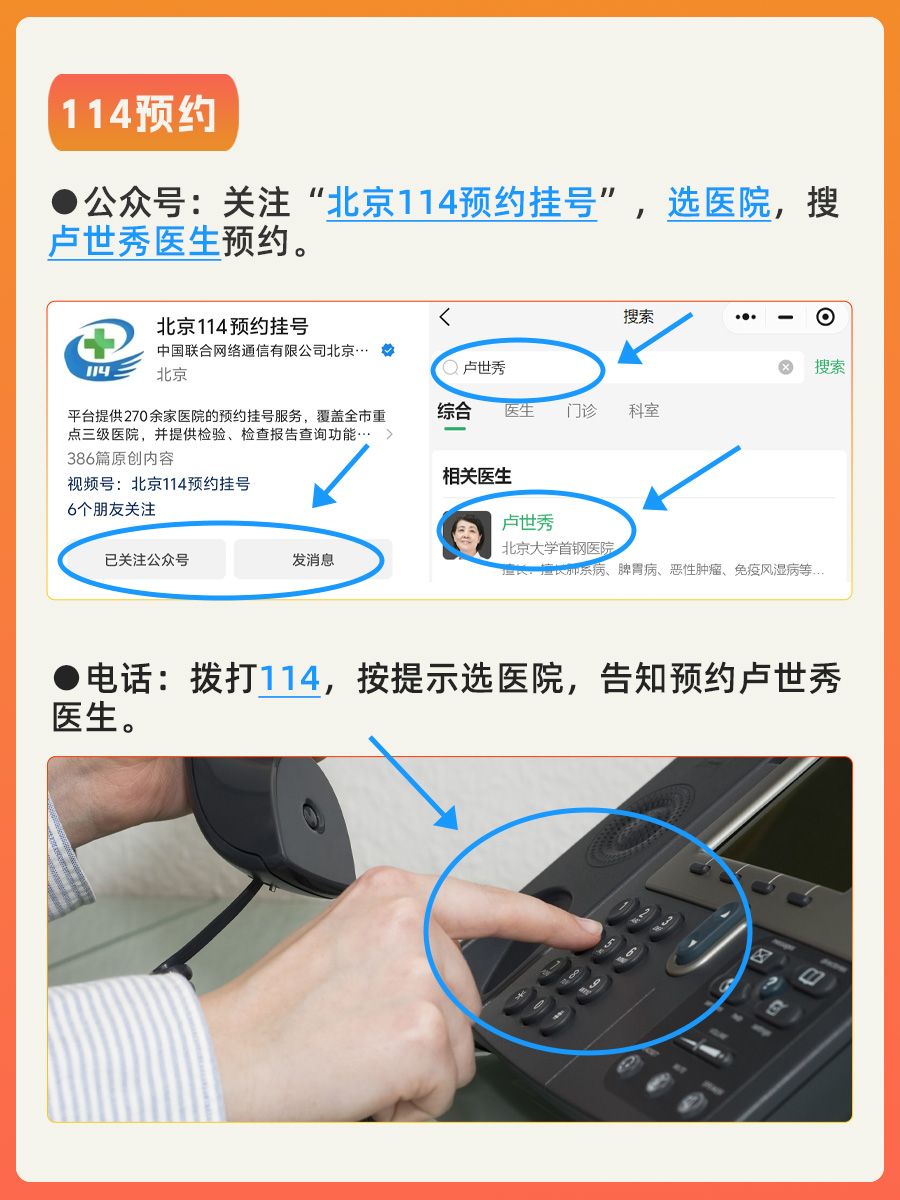 北京大学首钢医院卢世秀医生怎么样？怎么挂号?