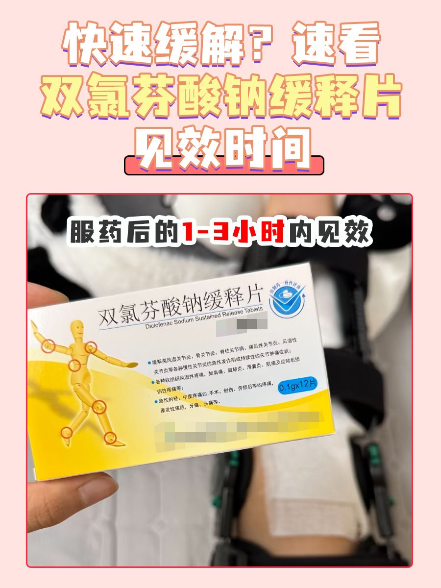 快速缓解？速看双氯芬酸钠缓释片见效时间