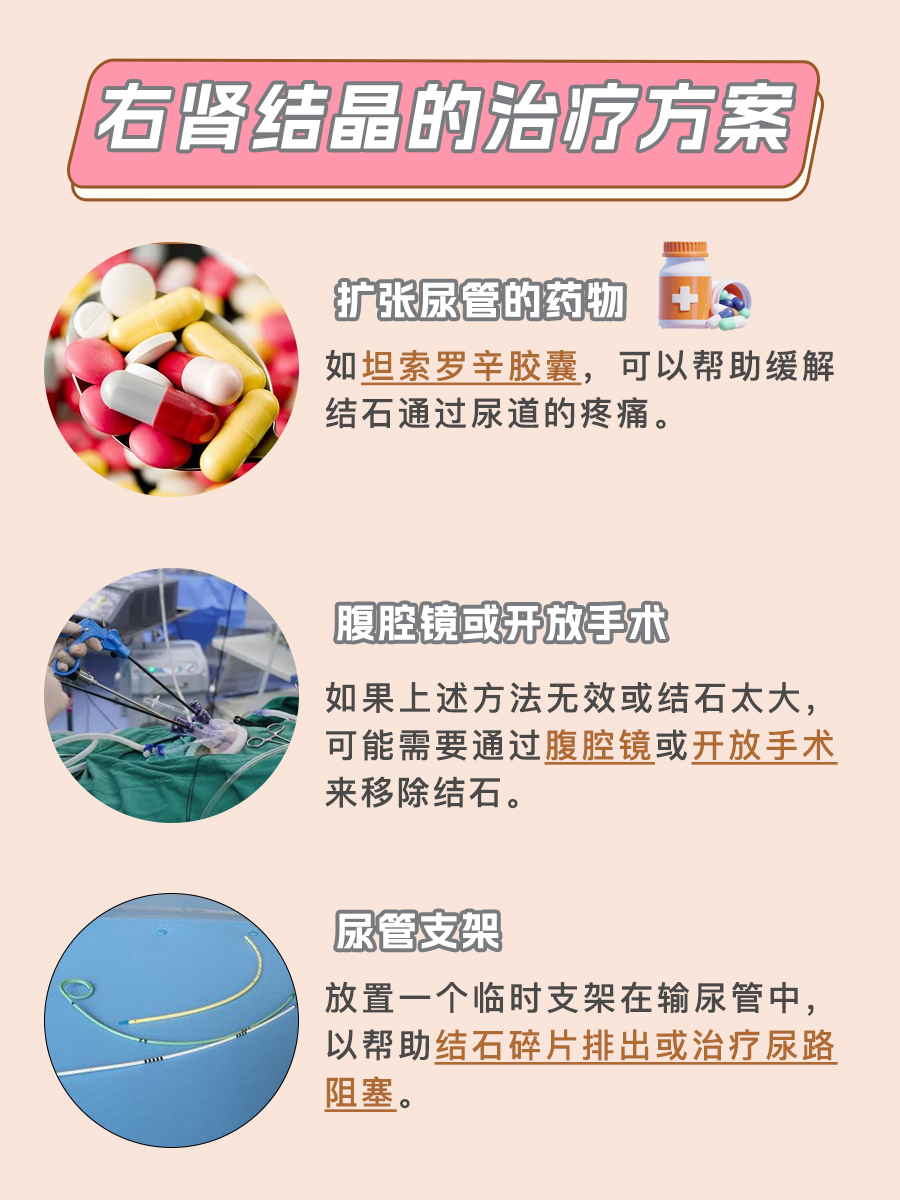 解析：右肾结晶的含义是什么
