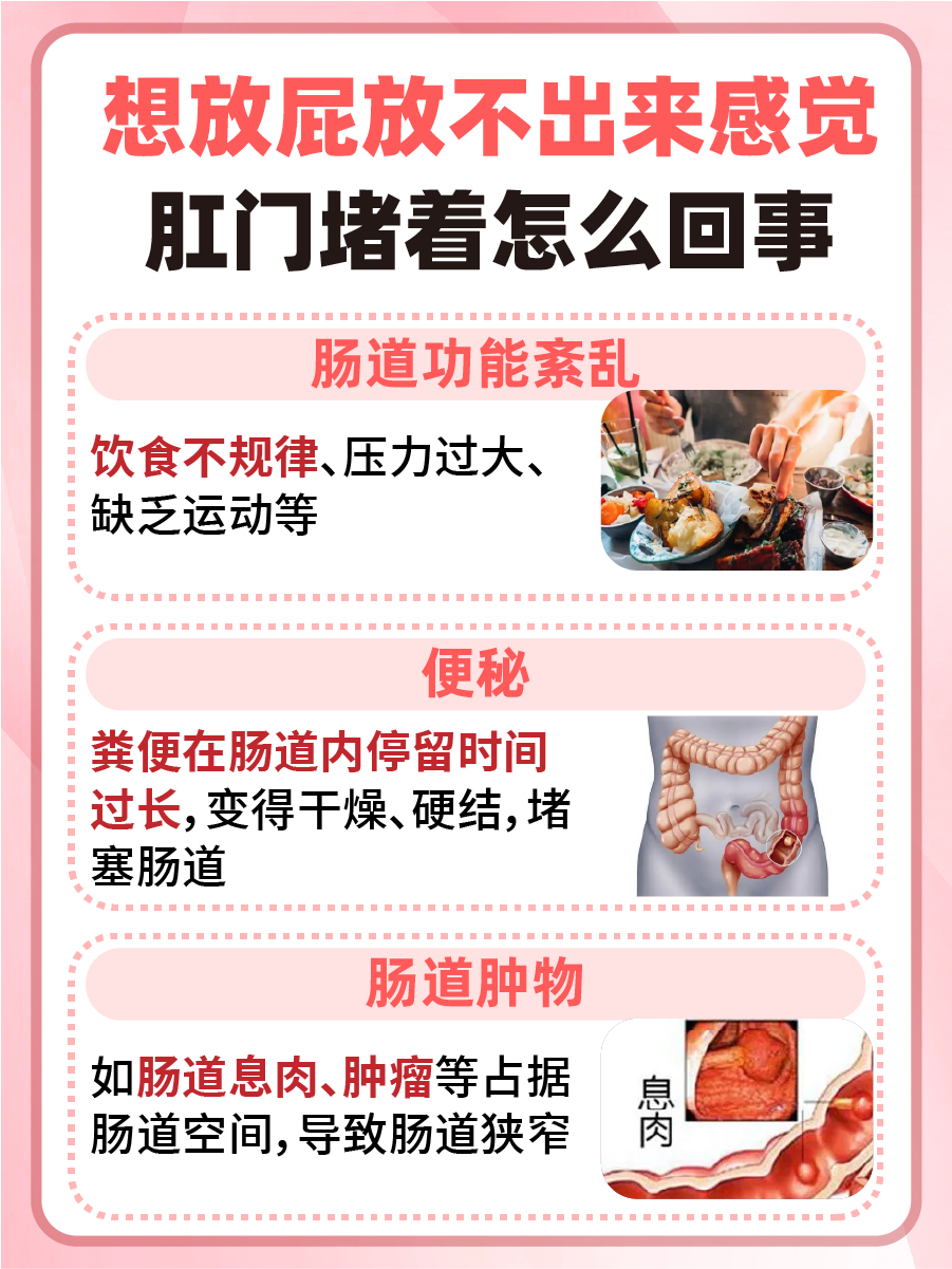 屁意难平?肛门堵塞感揭秘!