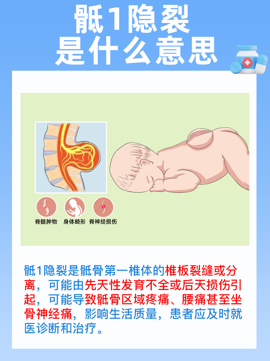 骶1隐裂是什么意思？一文解答