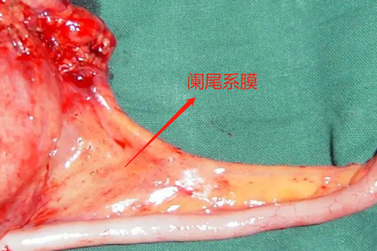 阑尾系膜图