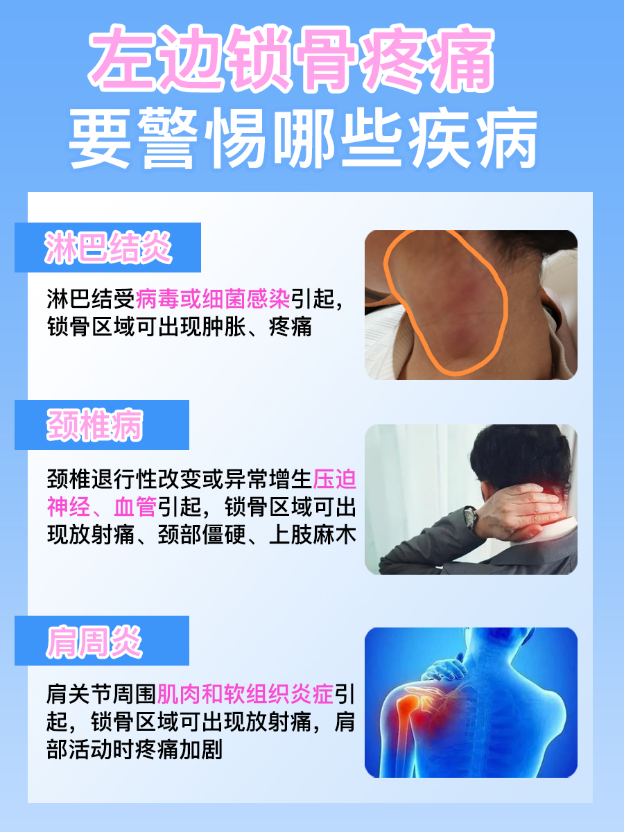 左边锁骨疼痛要警惕的三种病，你知道吗？
