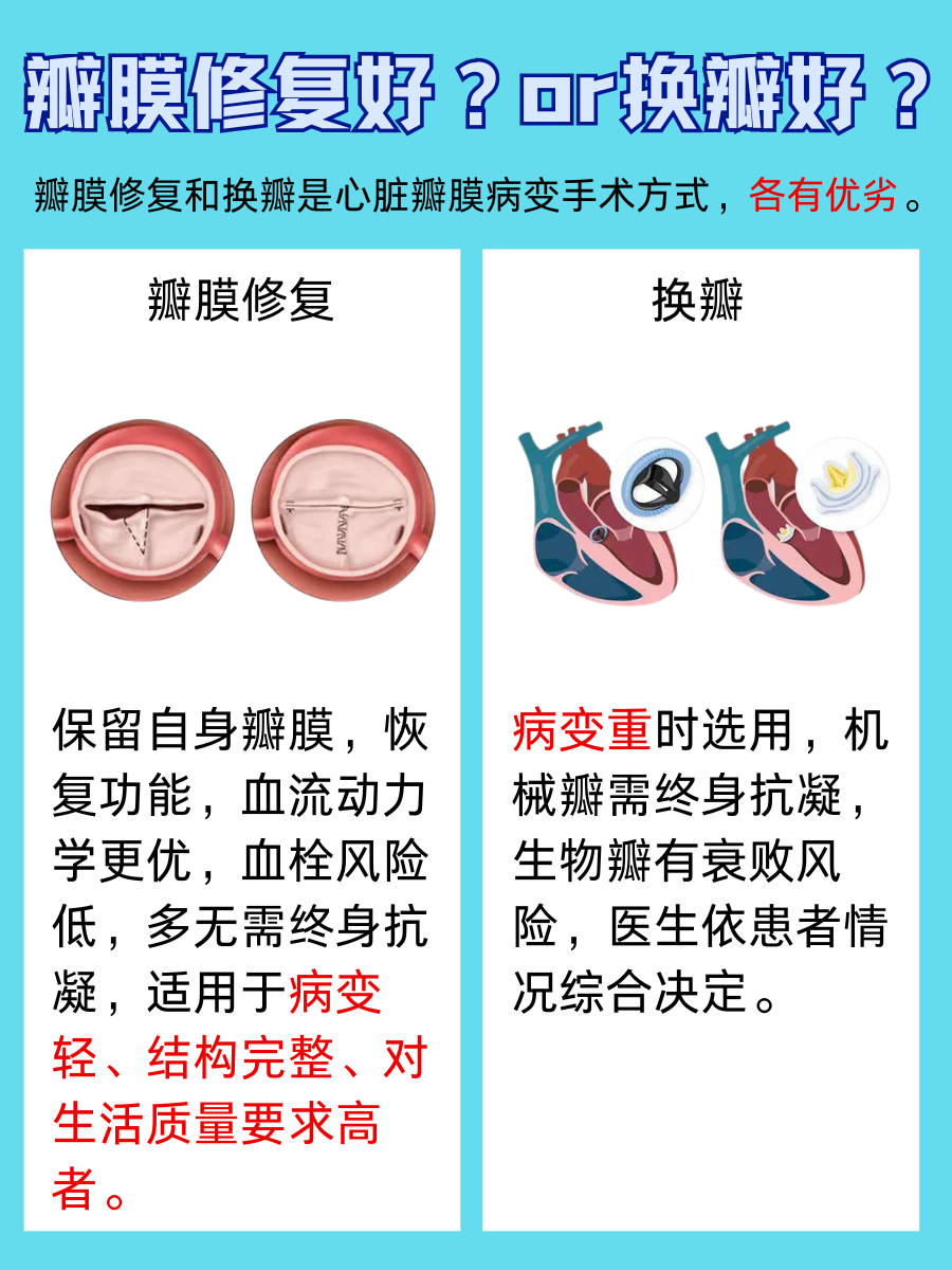 医生在线答疑:瓣膜修复和换瓣选哪个?