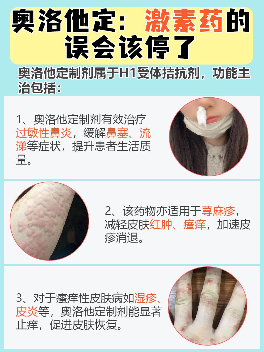 别再误解!奥洛他定非激素药物