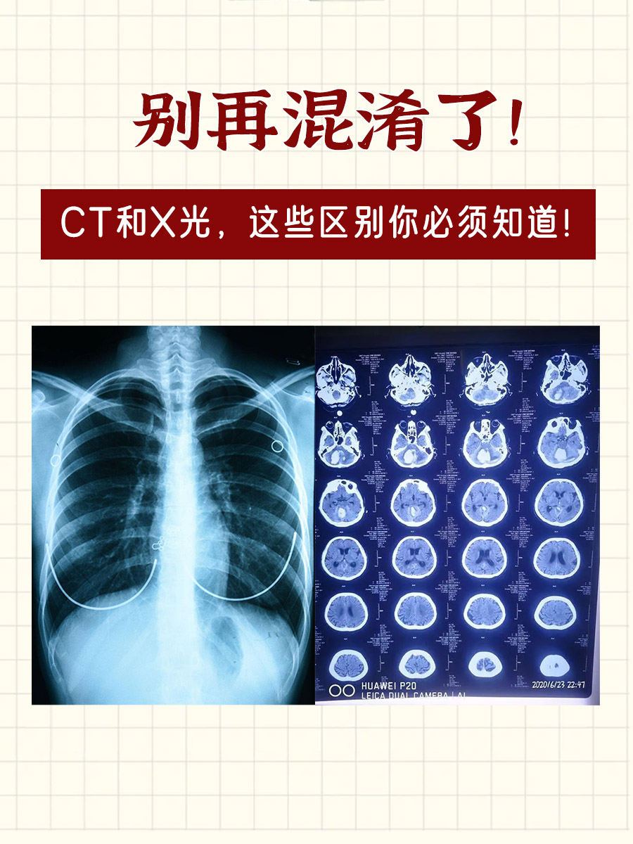 别再混淆了!CT和X光,这些区别你必须知道!