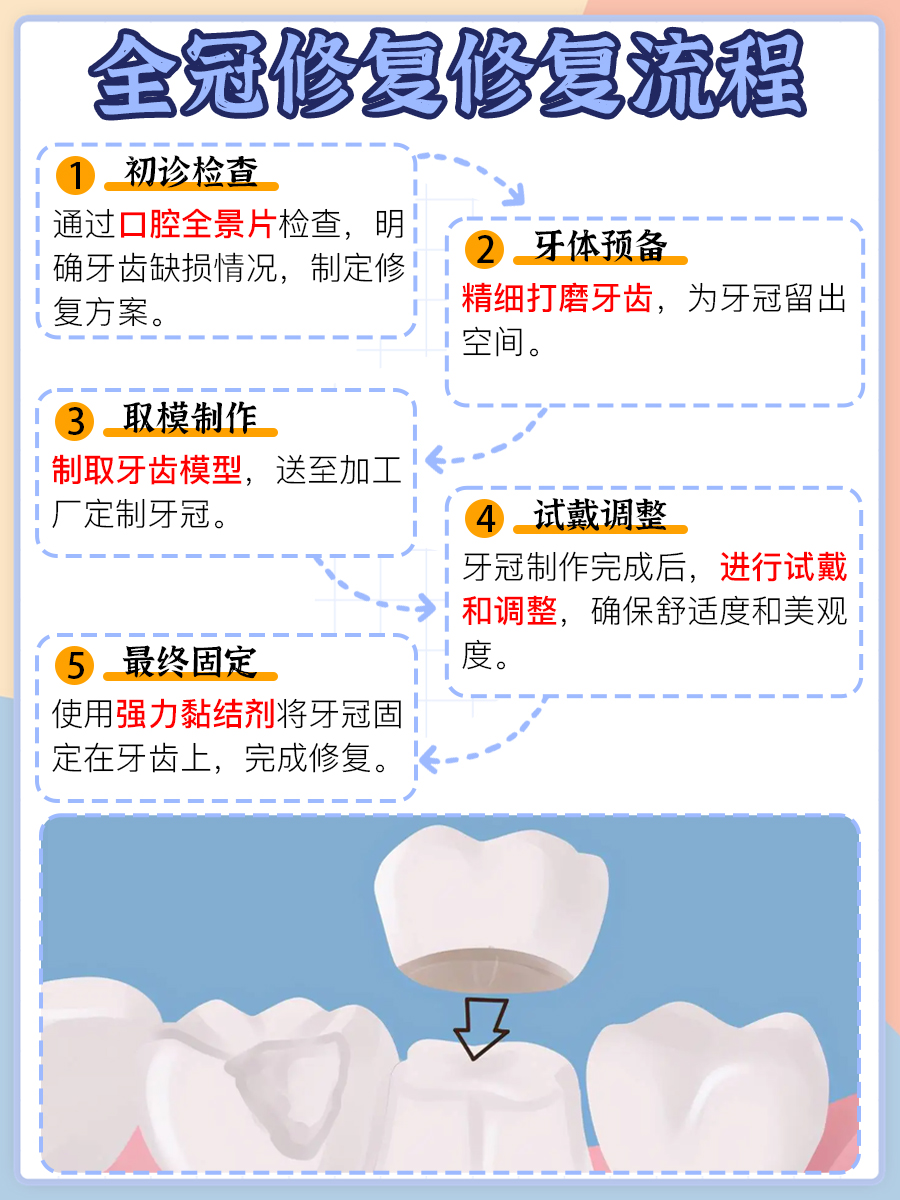 知识点get!医生揭秘全冠修复是什么意思