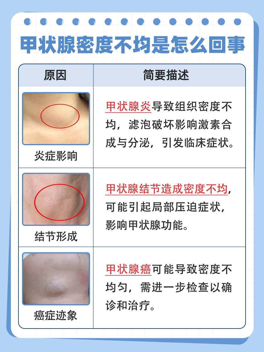 甲状腺密度不均是怎么回事？警惕这些疾病！