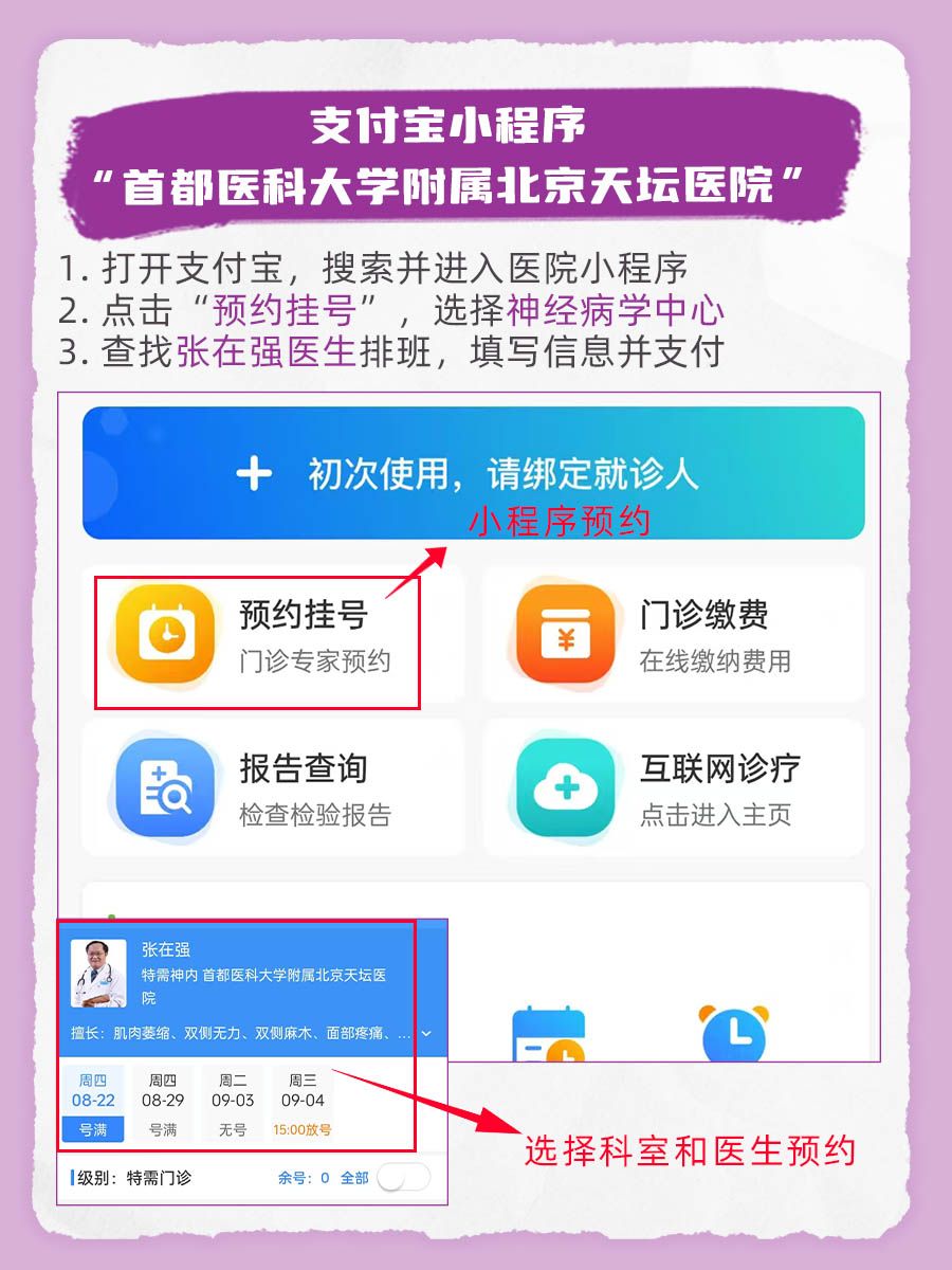 北京天坛医院张在强医生怎么样?怎么挂号?