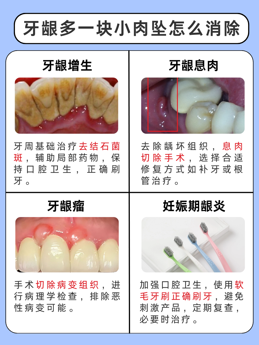 必看！牙龈多一块小肉坠怎么消除，答案在这里