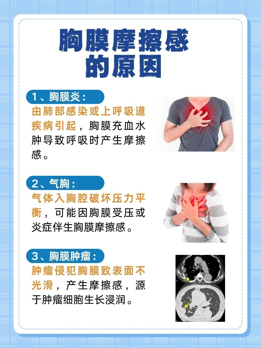胸膜摩擦感，原来是这些原因