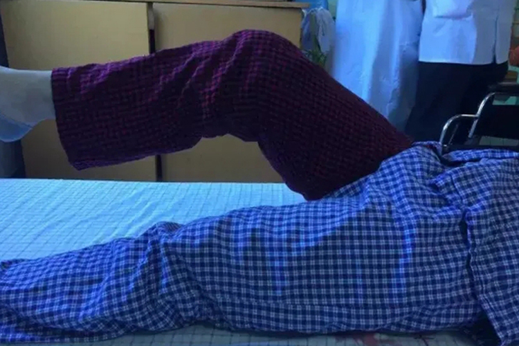 中度保护期恢复图