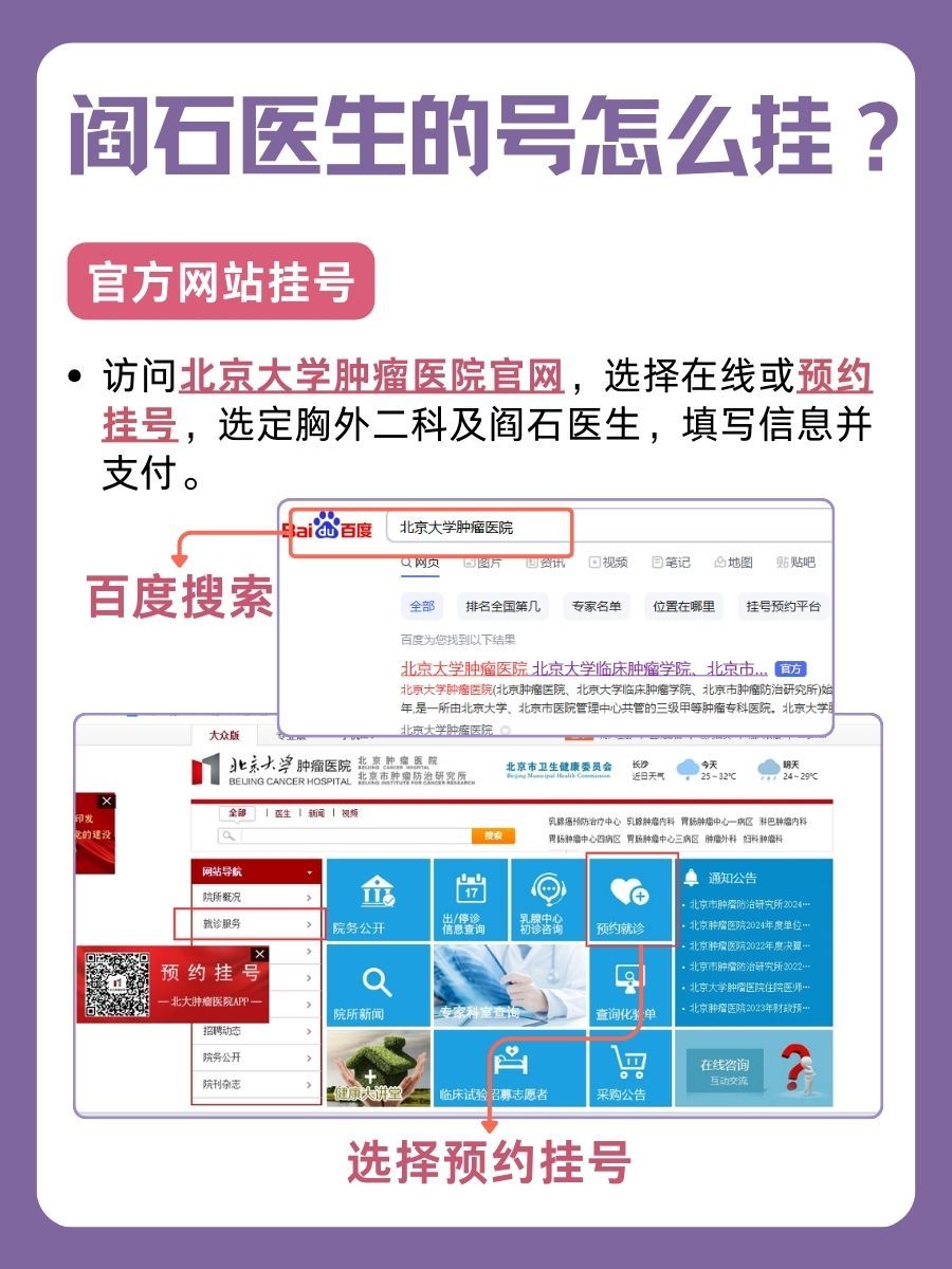 北京大学肿瘤医院阎石医生怎么样？怎么挂号？