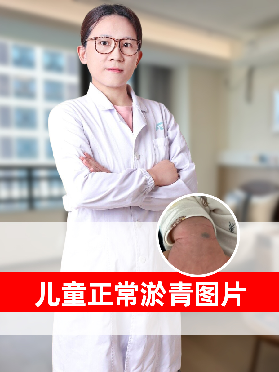 儿童正常淤青图片