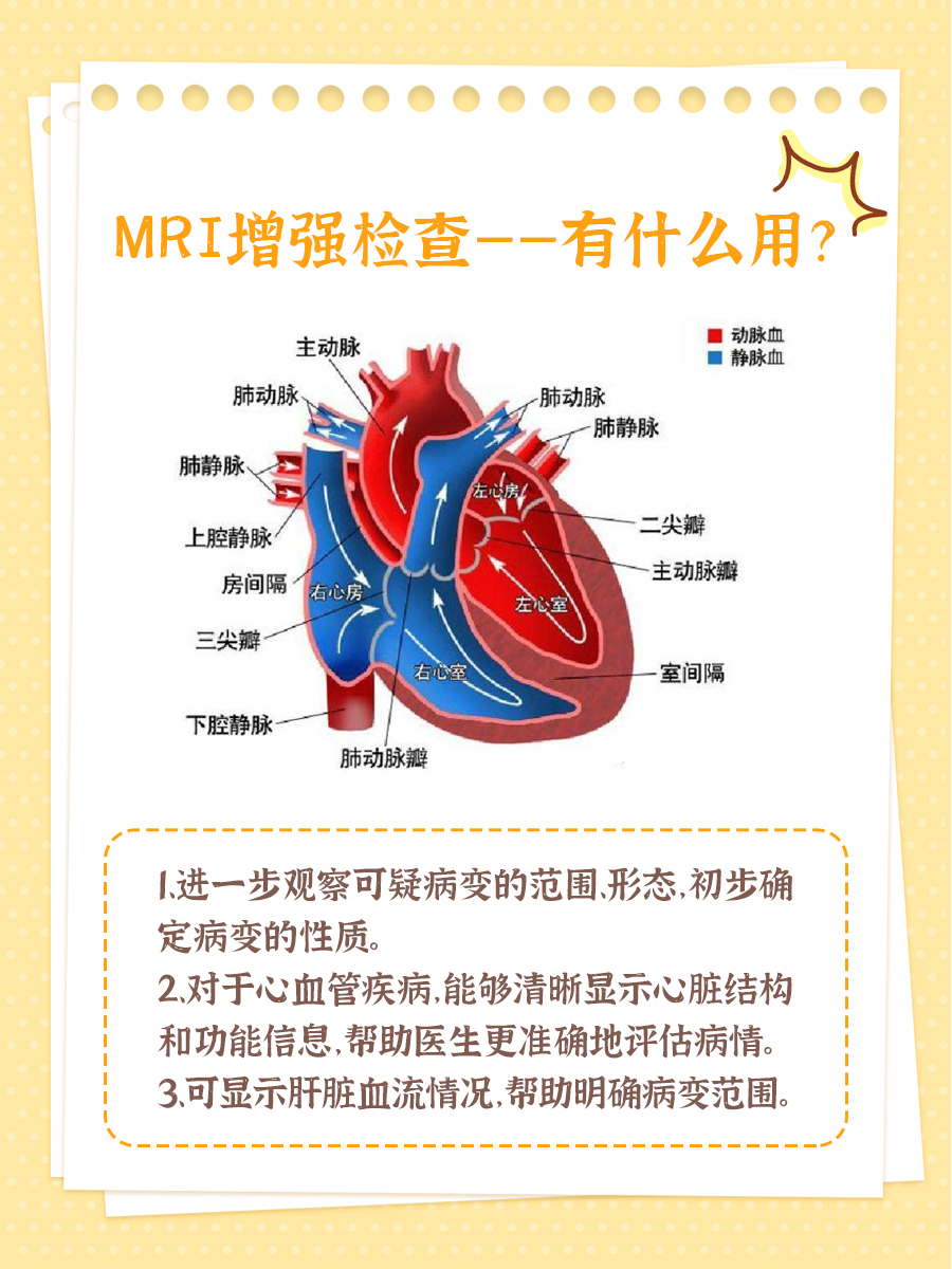 医生解析：MRI增强检查是什么意思