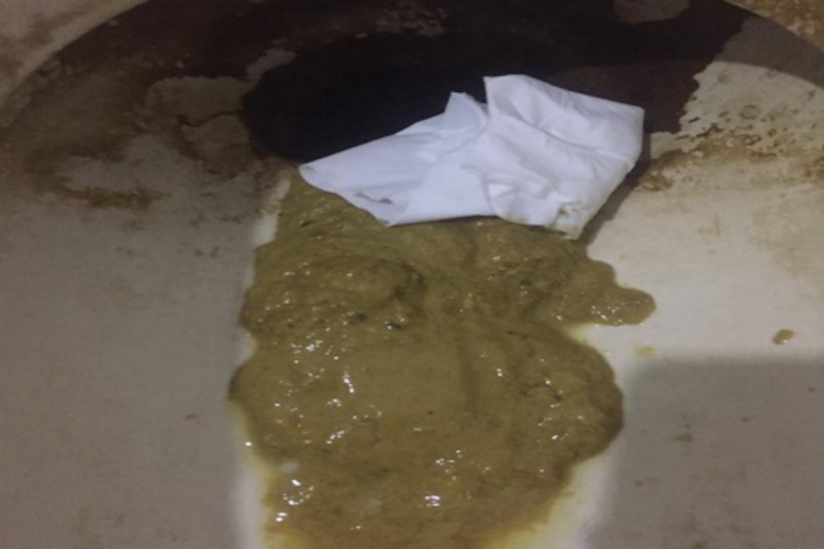 吃皮皮虾过敏腹泻图