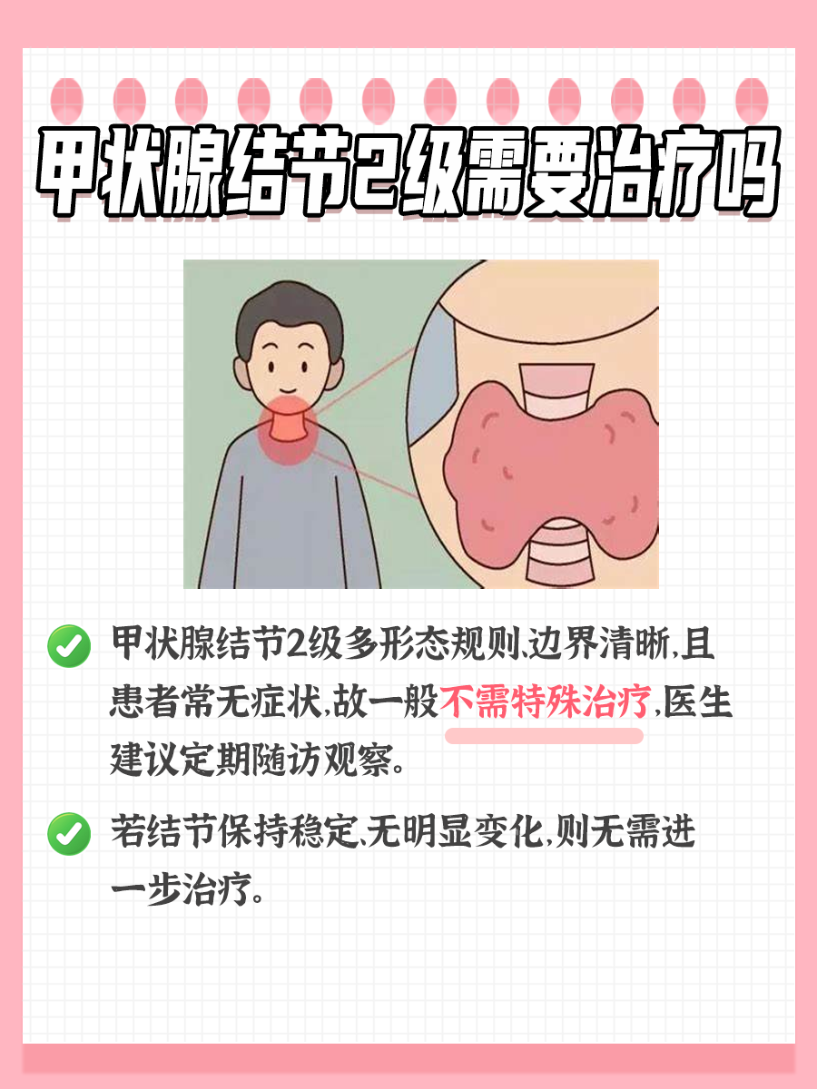 探究：甲状腺结节2级需要治疗吗？