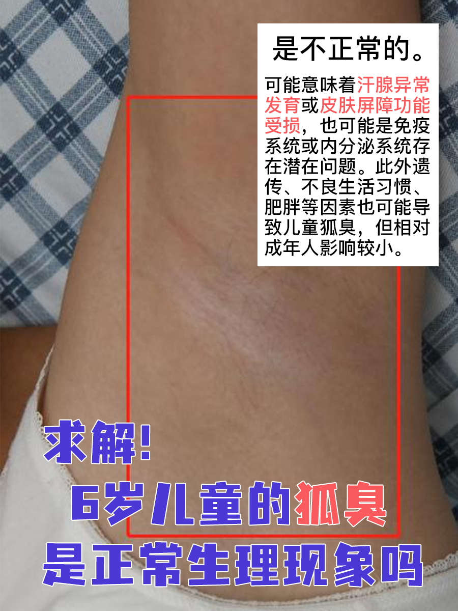 求解！6 岁儿童的狐臭，是正常生理现象吗