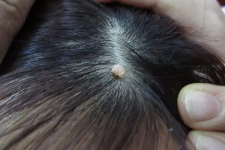 儿童头上长刺猴图