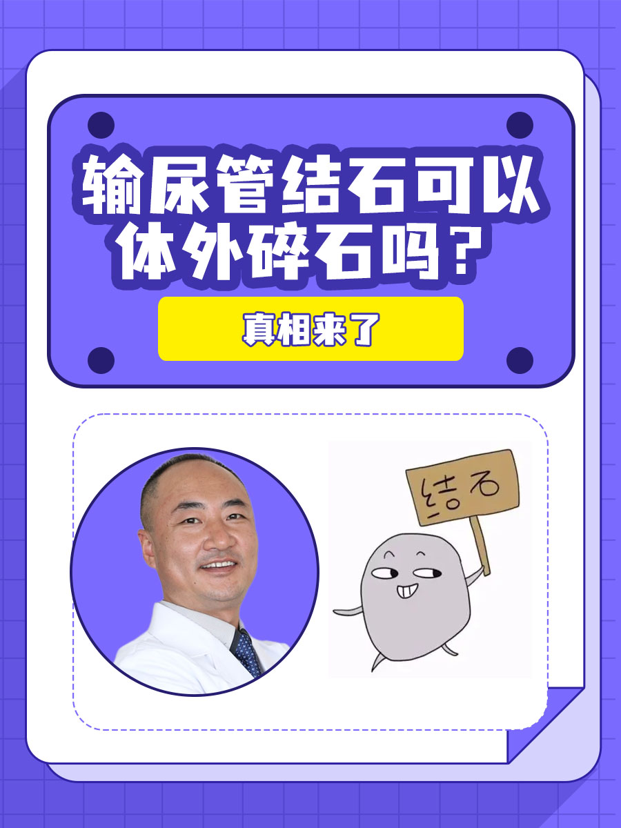 输尿管结石可以体外碎石吗？真相来了