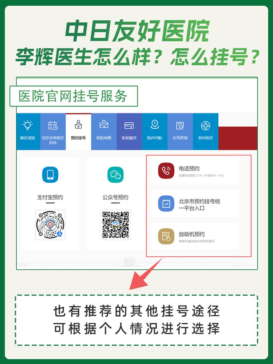 中日友好医院李辉医生怎么样？怎么挂号？
