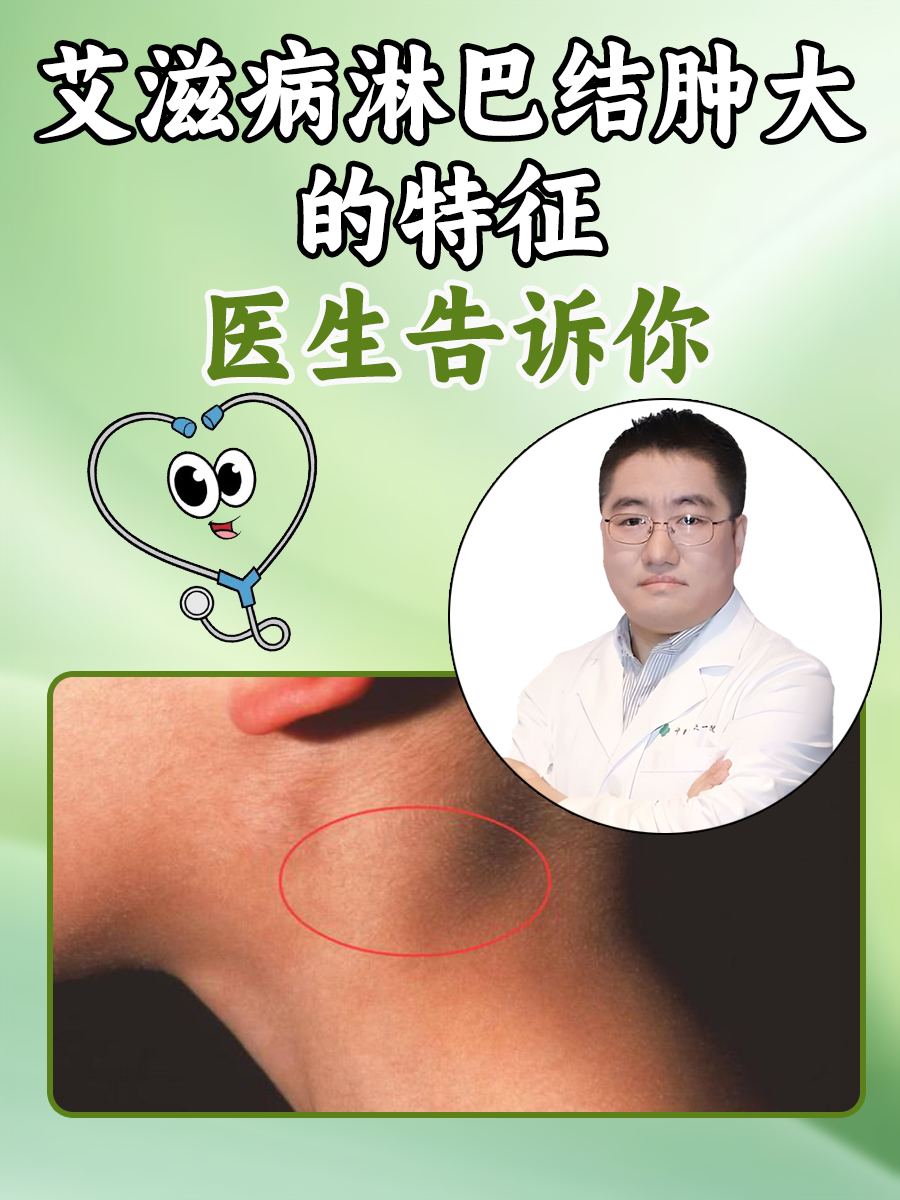 艾滋病淋巴结肿大的特征，医生告诉你