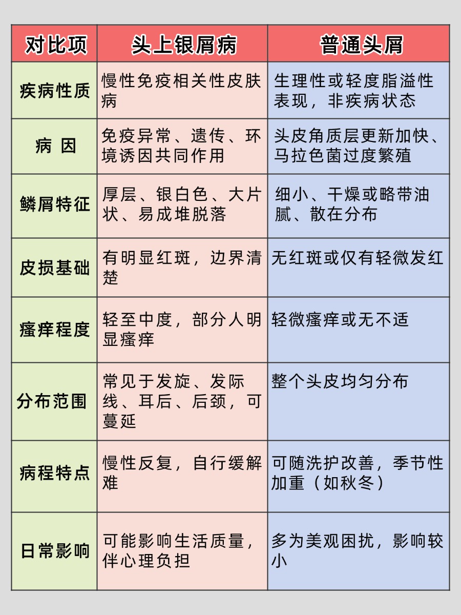 头上银屑病有哪些表现，4个关键特征速记！