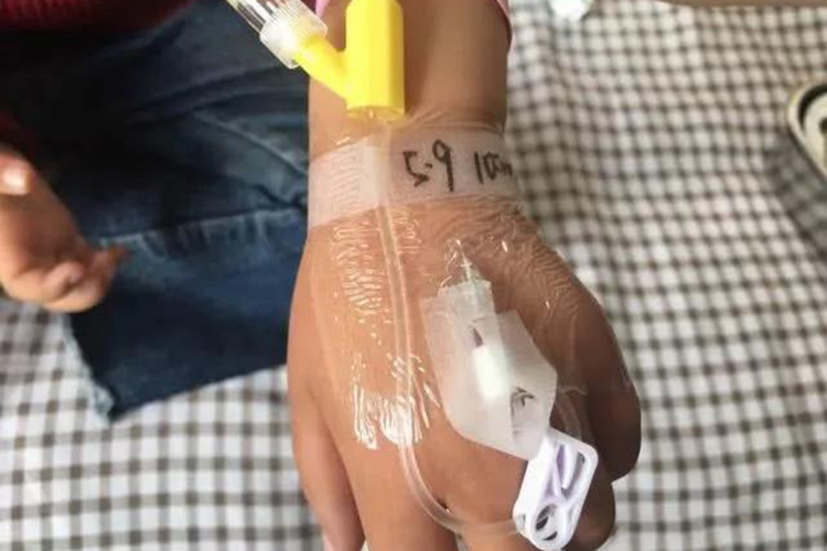 女生扎留置针手部图 女生扎留置针手部图