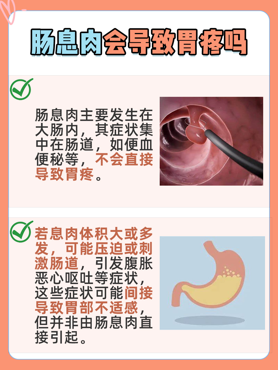 详细解析：肠息肉会导致胃疼吗