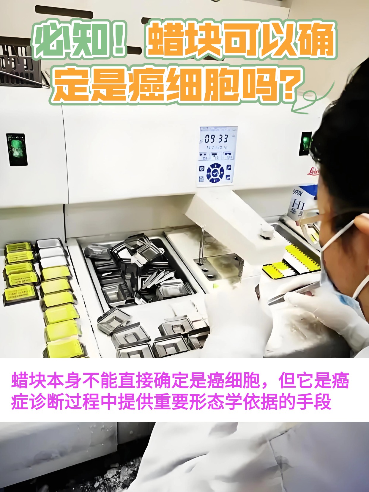 必知！蜡块可以确定是癌细胞吗？