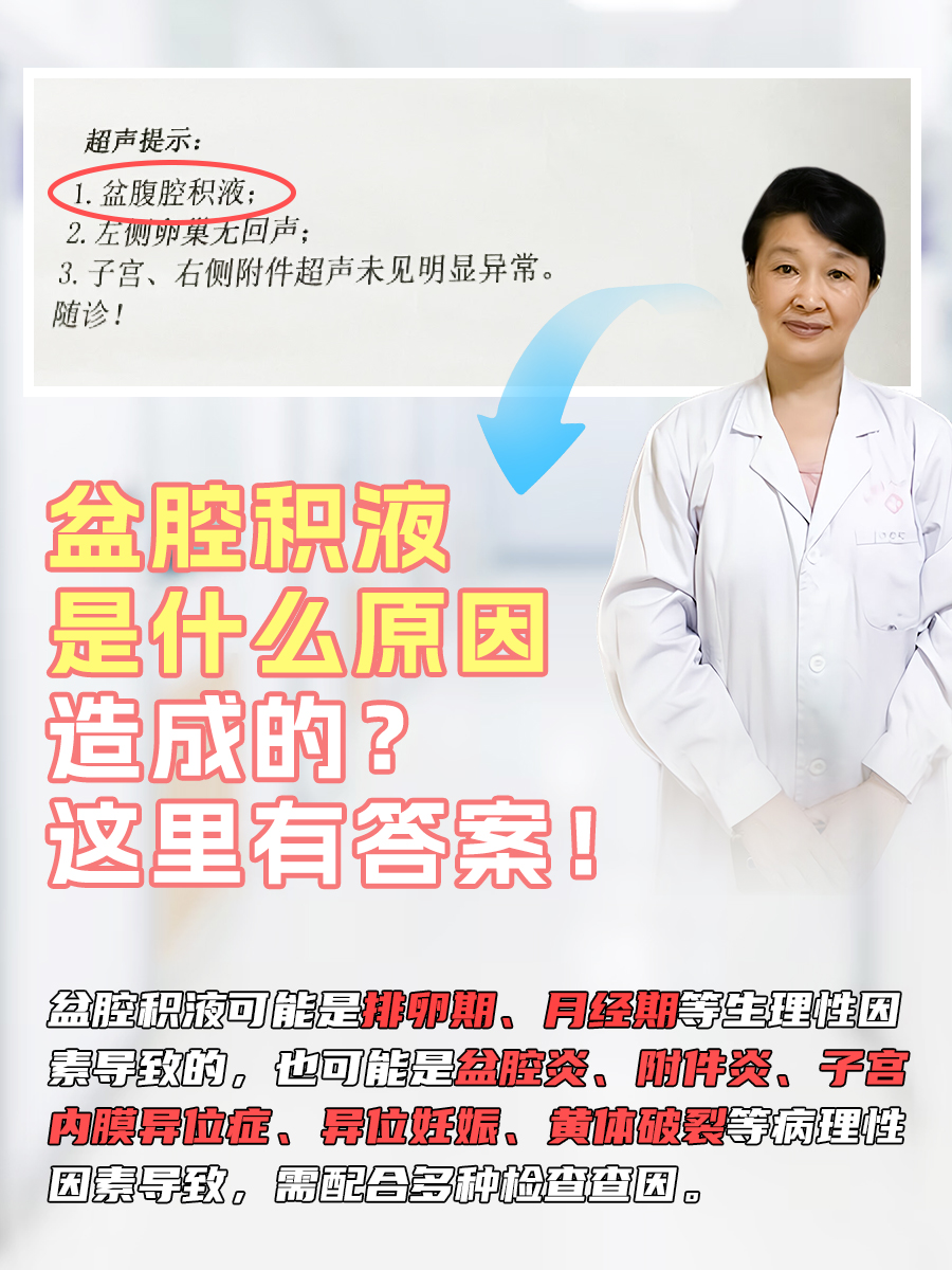 盆腔积液是什么原因造成的?这里有答案!