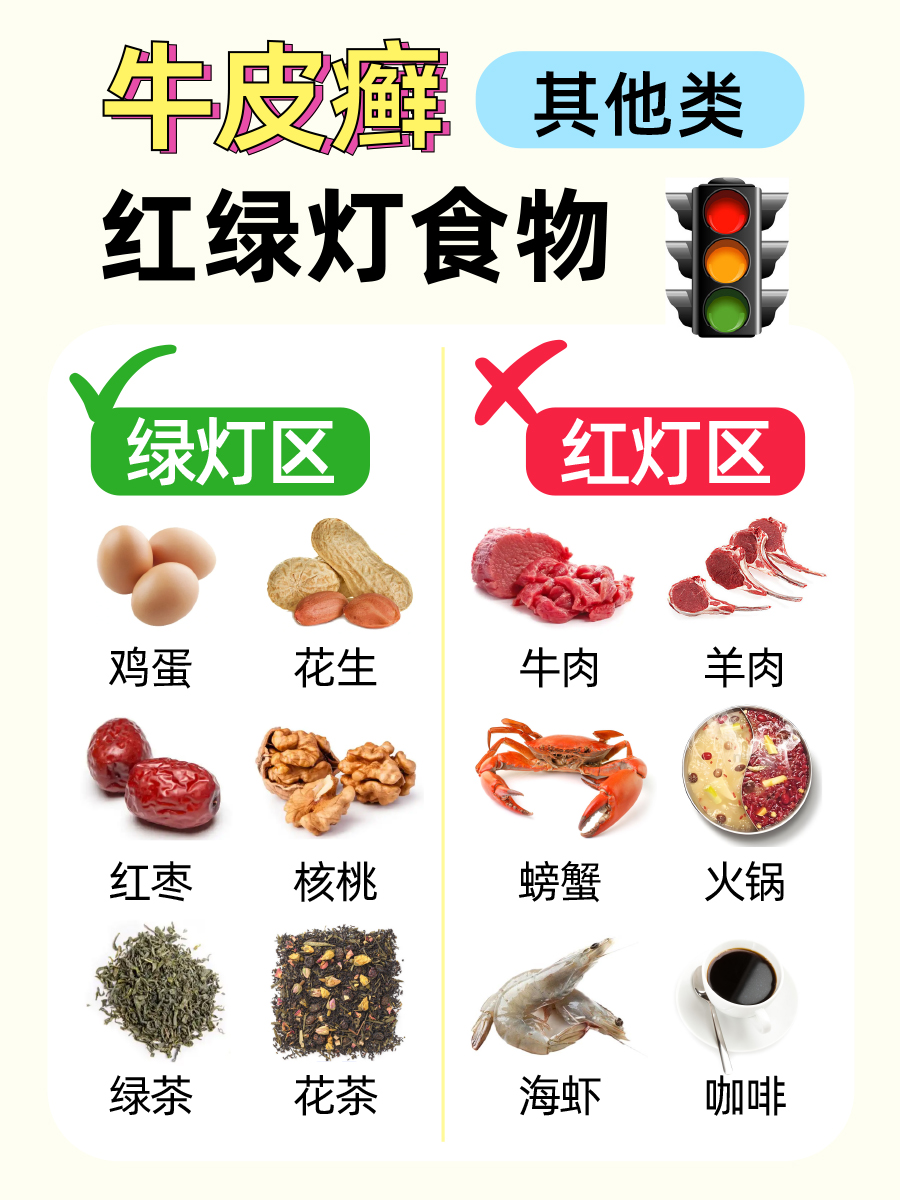 牛皮癣提高免疫力的方法，银屑病友别划走！