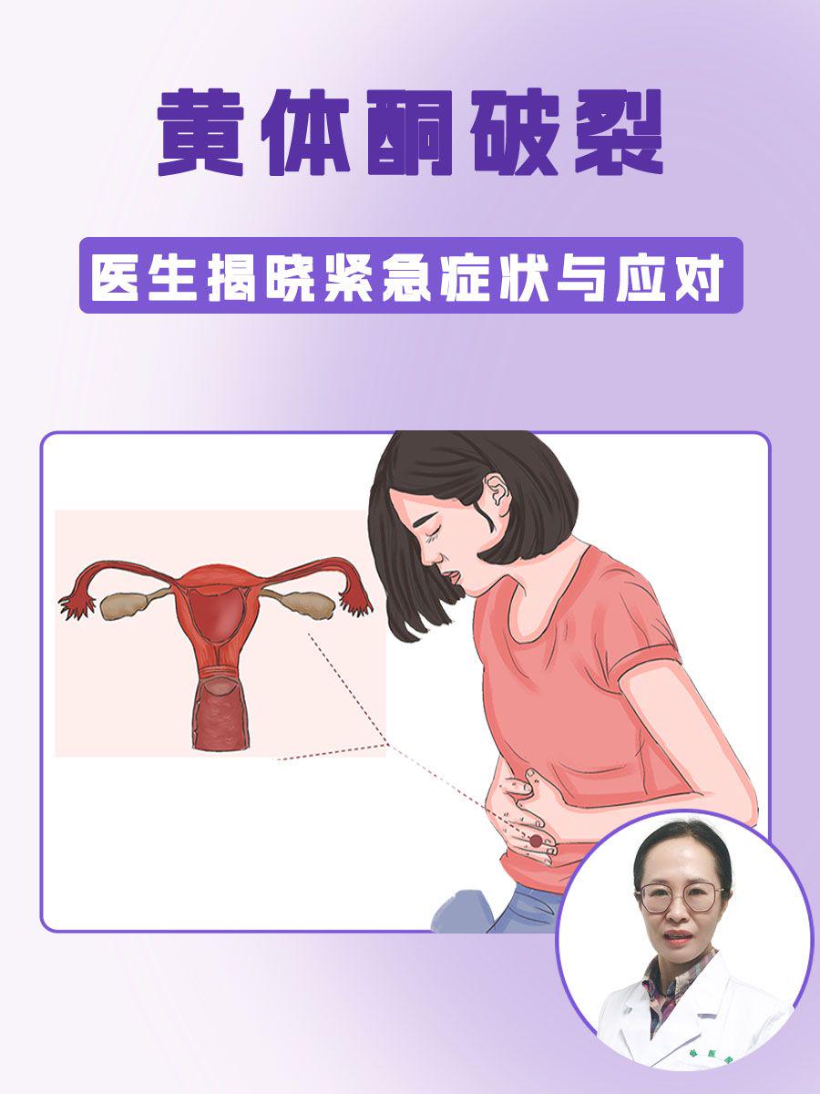黄体酮破裂,医生揭晓紧急症状与应对